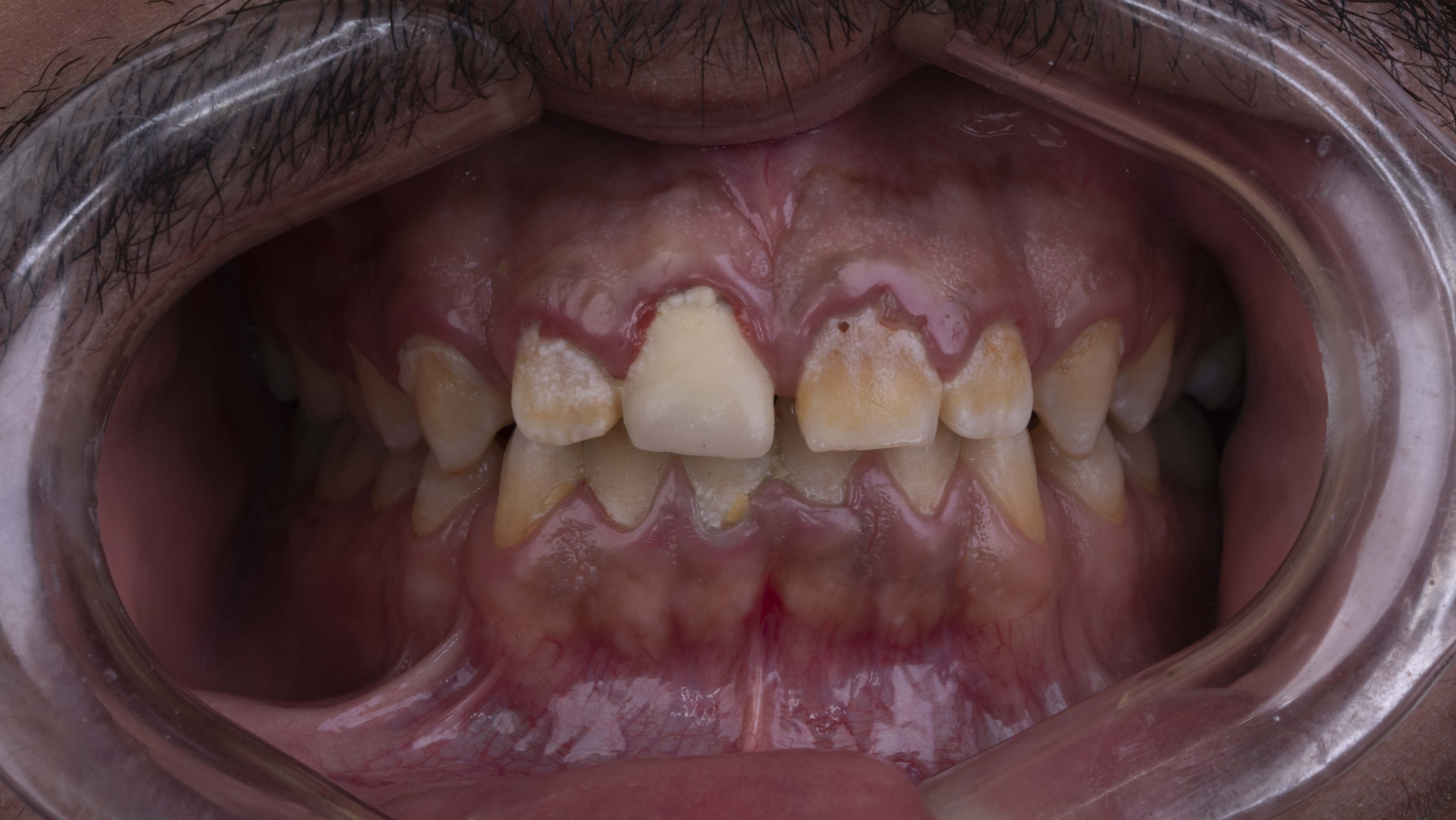 Case 2 after